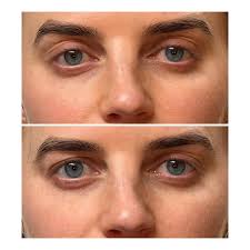 The eyes are the window to your soul...pair them with a beautiful brow❤️ A  beautiful eyebrow frames the face, can make you look a decade younger &  brings out your best features.