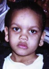 Food Deprivation Archives