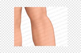 Wrist and hand forearm elbow upper arm pectoral girdle and shoulder nerves vascular supply axilla. Thigh Elbow Anatomy Upper Limb Skin Hand Hand Ankle Png Pngegg