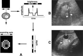 A systematic review of the. Sonographic Evaluation Of Renal Failure American Journal Of Kidney Diseases