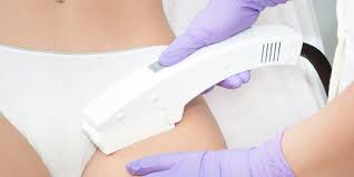 Il Y A 9 Ans Je Testais L Epilation Au Laser Voici Mes Conseils Si Vous Hesitez A Vous Lancer Le Huffington Post Life