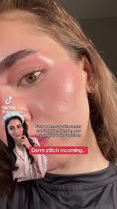 Image result for skin cancer on nose pimple