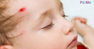 Memilih tempat tidur bayi tidak bisa sembarangan karena mempengaruhi kesehatan si kecil. Jika Anak Kerap Jatuh Kepala Terhantuk Boleh Menyebabkan Pendarahan Dalam Periksa 8 Perkara Ini Pa Ma