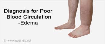 The process outlined here is the basic, fundamental way in which our bodies work. Poor Blood Circulation Causes Symptoms Diagnosis Treatment