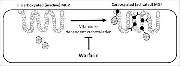 Factor ii vii ix x protein c protein s. Warfarin And Vascular Calcification The American Journal Of Medicine