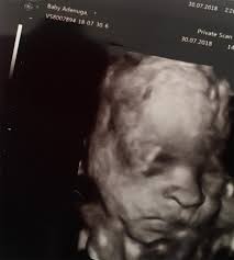 Fans are speculating if naomi campbell is pregnant after her rumored boyfriend, skepta, posted a sonogram on his instagram. Is Naomi Campbell Pregnant At 48 See Reason For Speculation Hollywood Life