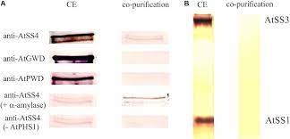 (amyloplasts are plastids that have developed into storage units.) plant vacuoles often take up the whole centre of a mature cell; Frontiers Parameters Of Starch Granule Genesis In Chloroplasts Of Arabidopsis Thaliana Plant Science