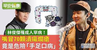 宅男腐女的爱好导航。 地址发布页： lanse.icu 最新地址： ldh. æž—ä¿Šå‚'ç½¹æˆäººç½•ç—… å˜´å†'70é¡†æ½°ç˜çˆ›ç˜¡ç«Ÿæ˜¯å±éšª æ‰‹è¶³å£ç—… æ—©å®‰å¥åº·