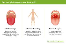 Check spelling or type a new query. Scharlach Symptome Verlauf Schutzmassnahmen