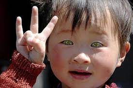 cat eyed chinese boy who can see in the night cats that dont shed benadryl for cats cats