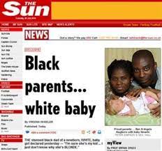 White Baby Born To Black Parents