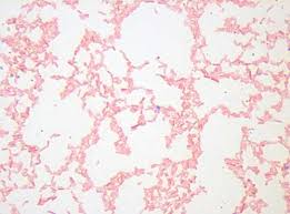 Detected in broiler chicken carcasses in zambia. Acop Ejournal