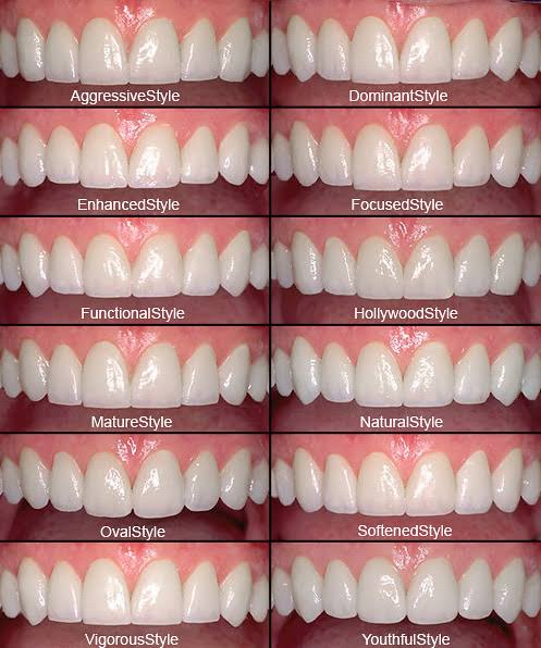 Smile Design – yayladent