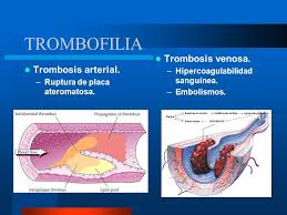 We did not find results for: El Estado Hipercoagulable Ppt Video Online Descargar