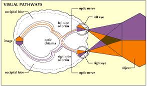 stroke hemianopsia visionaware