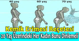 Fark edilmesi çok kolay olmayan bu hastalığın birçok belirtisi. 20 Yas Uzerindeki Her Kadin Bunu Dinlemeli Kemik Erimesi Recetesi Pratik Tarifim