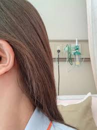 人工 内耳 ブログ