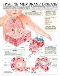 What Is Hyaline Membrane Shannon S Coding Consultations Facebook