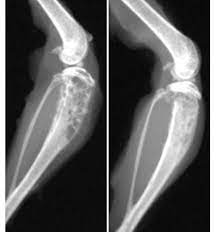 Huntsman Scientists Identify Bone Degradation Process Within Metastatic Breast Cancer