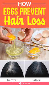 Dermatologists advise that fish like tuna and mackerel, which have high mercury levels, may cause hair loss. How Eggs Prevent Hair Loss And Aid Hair Growth Prevent Hair Loss Treat Hair Loss Egg For Hair
