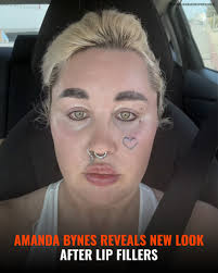 Amanda, 39, revealed