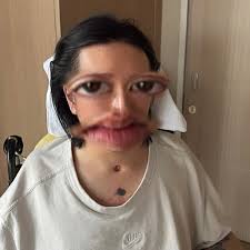 Paralysed Hong Kong Mirror dancer's medical funding thrown into jeopardy