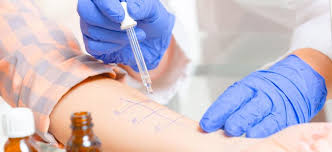 For this test, a doctor or nurse will scratch the skin with a tiny bit of liquid extract of an allergen (such as pollen or food). Skin Prick Tests Food Allergy Research Education