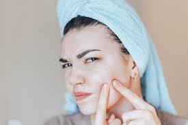 Acne De L Adolescent Comment Choisir Le Traitement Adapte A Ses Boutons
