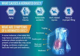 Here are some symptoms of slipped disc 2 also there are some motions which can cause slipped disc. Herniated Disc Causes And Prevention Tips