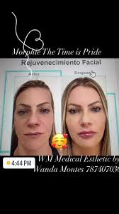 WM MEDICAL ESTHETIC BY WANDA MONTES