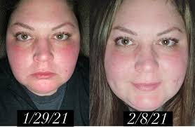 Beauty Booster skin care product review