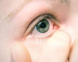 Kalte umschläge helfen bei geröteten, brennenden und juckenden augen. Gesundheit Wenn Das Auge Juckt Und Brennt