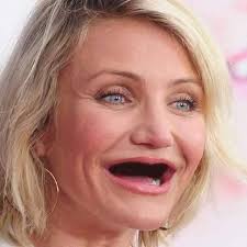 Los chimuelos más famosos del espectáculo