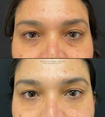 Dr. Adam Lowenstein (@montecitoplasticsurgery) • Instagram photos and videos