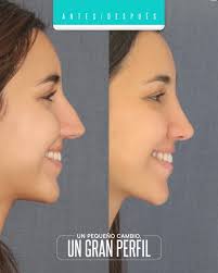 La Cosmiatra Nancy Álvaro es la profesional que brinda cuidados  especializados de la piel, garantizando un post operativo óptimo para el  paciente. ✨ Comunícate con nosotros y conocé todos nuestros servicios: 📱