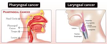 According to the american dental association (ada), those who use tobacco and/or drink are more likely to develop mouth cancer, as are people over the age of 44 and, more specifically, men. Throat Cancer Treatment In Jaipur Medical Oncologist Tarachand