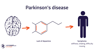 Parkinson's disease (pd) is growing at an alarming pace, putting it on a path to become. Cycling With Parkinson S Disease Van Raam