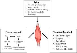Sarcopenia is a syndrome characterized by progressive and generalized loss of skeletal muscle mass and strength and it is strictly correlated with physical disability, poor quality of life and death. References In Sarcopenia Aging In Cancer Journal Of Geriatric Oncology