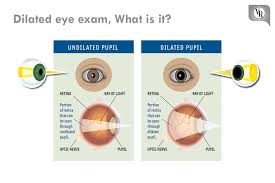 Dilated Eye Exam What Is It A Dilated Vision Exam Allows