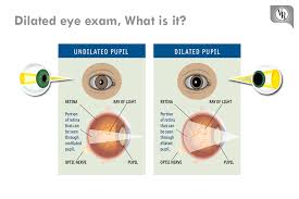 dilated eye exam what is it a dilated vision exam allows