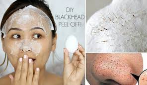 Tetapi bukan semua orang mampu untuk melakukannya. Tak Perlu Picit Blackhead Whitehead Akan Hilang Dengan Mudah Guna 9 Cara Ini Maskulin