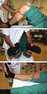 Image result for PCL Sulcus Test