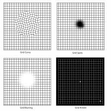 macular degeneration grid check your vision with an amsler grid