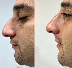 Danny Antonio Escobar Herrera