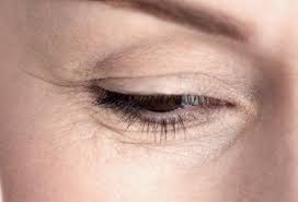 Uneven Skin Tone Too Much Sun Also Causes Irregular Coloring Or Pigmentation Of The Ski Home Remedies For Wrinkles Under Eye Wrinkles Health And Beauty Tips