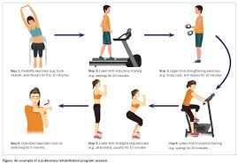 Image result for Exercise in COPD
