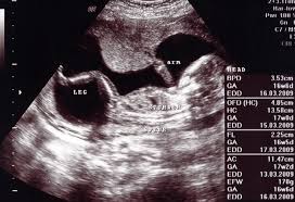 Ask your specialist to give you a rough idea of how long your test results are likely to take. 16 Weeks Pregnant Ultrasound Procedure Abnormalities And More