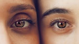 Children are not just small adults. Lasik Vs Advanced Surface Ablation Asa Brimhall Eye