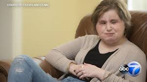 The amazing transformation was only made possible when rodebaugh's mom agreed to the transplant, noting that her son had always wanted to be a firefighter. Suicide Attempt Survivor Is The Youngest Face Transplant Recipient In U S History Abc11 Raleigh Durham