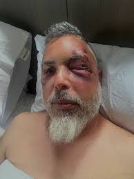 We have a member of the bbq community in need. Please go and support a bbq  community brother @bklynpitrat2.0 that was assaulted